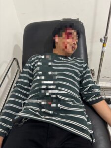 Diduga Dianiaya Anak Pensiunan Polisi di Rumah Kost Rajabasa, Korban Lapor ke Polsek Kedaton