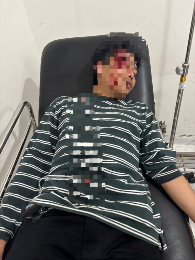 Diduga Dianiaya Anak Pensiunan Polisi di Rumah Kost Rajabasa, Korban Lapor ke Polsek Kedaton